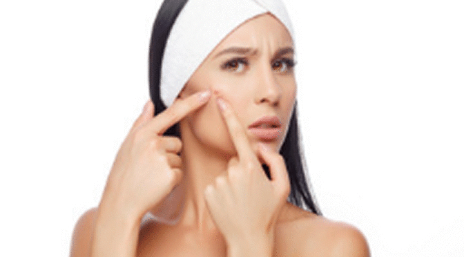All About Acne Prevention